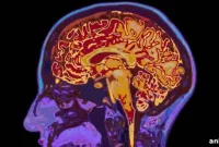 New MRI Study Reveals How the Brain Safeguards Memories