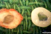 Cornell Bioengineers Spinal Disc Implants to Treat Back Pain