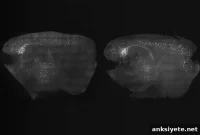 How Brainwave Stimulation Could Ease Alzheimer’s Symptoms