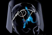 Deep Brain Stimulation Brings Relief for Severe Depression