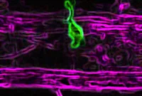 New Study Finds Microglia Outside the Central Nervous System