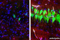 Scientists Restore Pig Brain Activity Hours After Death