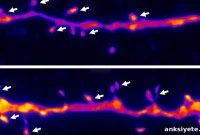 New Drug Offers Ketamine-Like Rapid Relief for Depression