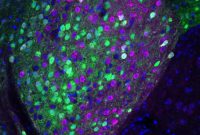 Why We Overeat Tasty, Calorie-Rich Foods: Brain Science
