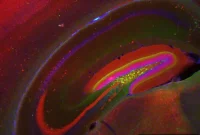Blocking One Protein Reverses Memory Loss in Aged Mice