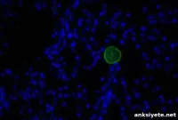 Is Toxoplasma gondii Altering Behavior or the Immune Response?