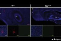 Scientists Restore Neurons in Dementia Mouse Model