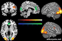 Disfigured Faces Trigger Negative Brain and Behavior Responses