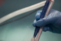 Artificial Nose Pinpoints Cancerous Tissue in Brain Tumor Surgery