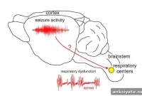 Gene Mutation Raises Sudden Death Risk in Epilepsy