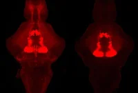 Role of Serotonin in Sleep: What Research Shows