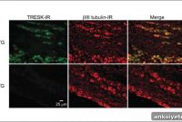 Defective Potassium Channels Cause Headaches, Not Body Pain