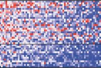 Gut Microbiome Linked to ALS Progression