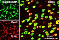 Brain Region Linked to Social Behavior Changes in Autism Model