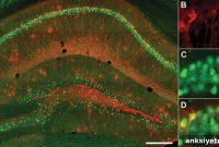 How Storing Negative Memories Affects Depression Symptoms