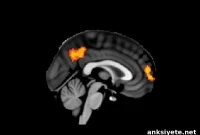 White Matter Predicts Who Will Respond to Brain Stimulation