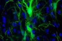 Brain Stem Cells Survive Transplant Without Immunosuppressants
