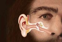 Could a Childhood Disease Have Caused Neanderthal Extinction?