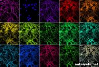 New Imaging Technique Reveals Single Proteins in Synapses