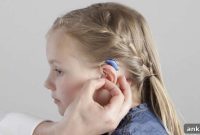 Childhood Mild to Moderate Hearing Loss Rewires Sound Processing