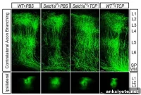 Researchers Reverse Key Schizophrenia Symptom in Adult Mice
