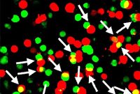 Sticky Gene Could Explain Why Valium Calms Anxiety