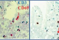 New Study: Fetal Gut Immunity Develops Before Birth