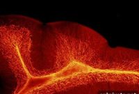 Low Placental Steroid Levels Linked to Increased Autism Risk