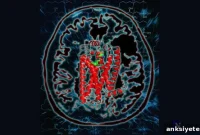 Molecular Map Identifies Drug Targets for MS and Other Diseases