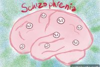 Hair Test Detects Schizophrenia Biomarker