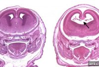CBD and THC in Early Pregnancy: Fetal Development Risks