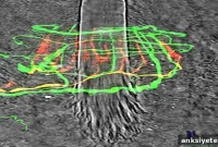 Molecular Mechanisms Underlying Touch Sensation