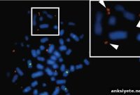 Extrachromosomal Noncoding DNA May Drive Glioblastoma