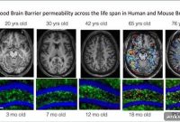 Drugs That Reduce Brain Inflammation May Reverse Dementia