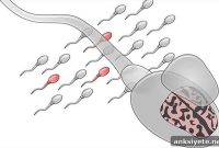 Sperm Mutations Linked to Autism Risk in Children