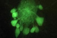 New Approaches to Identifying Brain Cell Types