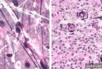 New AI Imaging System Accurately Detects Brain Tumors