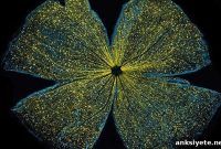 Gene Linked to Eye Aging Identified
