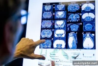 Rat Born With Almost No Brain Still Sees, Hears, Smells
