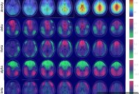 Army Uses Big Data to Advance Neuroscience Research