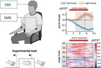 New Method Detects Motor-Related Brain Activity