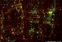Study Suggests Parkinson’s Biomarker Originates in Gut