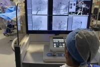 Surgeons Use Robot to Repair Brain Aneurysms