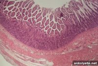 How Organs-on-a-Chip Model Complex Diseases