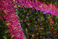 Targeting Early Brain Inflammation May Slow Alzheimer’s