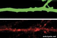 Lithium Shows Promise Against Behaviors Linked to Autism Gene