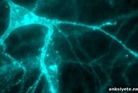 Molecular Cause of Rare Neurological Disease Suggests New Therapy