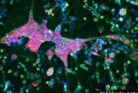 3D Brain Model Links Alzheimer’s to Herpes Simplex Virus