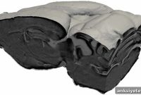 3D Imaging of Amyloid Plaques in the Brain