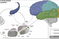 Auditory Hallucinations Linked to Abnormal Brain Connectivity